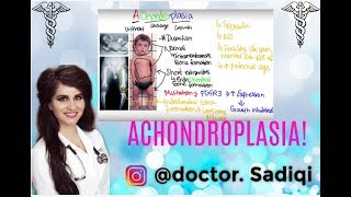 What is Achondroplasia [upl. by Jo-Anne743]