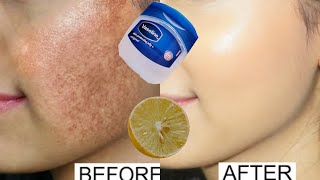 Vaseline and lemon for skin whitening  Vaseline for pigmentation and dark spots on face [upl. by Ymmaj310]