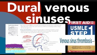 Dural venous sinuses  Venous sinus thrombosis in HindiUrdu by first aid for the USMLE step 1 [upl. by Eneroc]