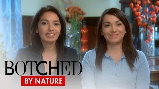 Botched by Nature  Twins Need Help on quotBotched By Naturequot  E [upl. by Yelknirb]