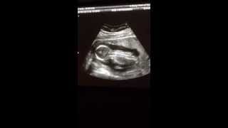 16 week ultrasound and Its a boy [upl. by Weathers434]