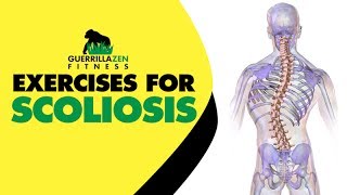 Exercises For Scoliosis  Unilateral Back Training [upl. by Arreik]