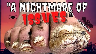 A Nightmare of Issues Trimming Fungal Toenails and A Surprise on the Big Toe [upl. by Riffle]