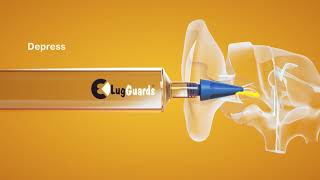 A quick demonstration of the how our LugGuards tip is used to treat wax blockages effectively [upl. by Inot]