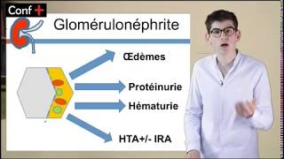 Rappel sur les glomérulonéphrites [upl. by Yarw396]