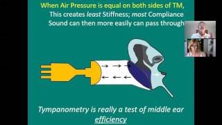 125 Tympanometry [upl. by Blasien791]