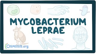 Mycobacterium leprae  an Osmosis Preview [upl. by Orhtej]