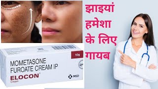 Elocon Cream Benefits  दाग धब्बे मिटाने की सबसे असरदार क्रीम  elocon cream review in hindi [upl. by Aihcrop]