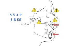 Cephalometrics Part I [upl. by Ornas]