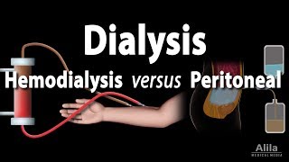 Renal Replacement Therapy Hemodialysis vs Peritoneal Dialysis Animation [upl. by Persas]