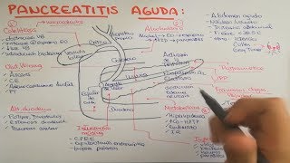 Pancreatitis causas fisiopatología clínica diagnóstico y tratamiento [upl. by Attennek607]