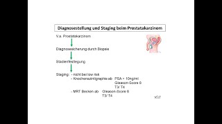 Diagnosestellung und Staging beim Prostatakarzinom  Strahlentherapie Prof Hilke Vorwerk [upl. by Aihtennek]