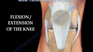 Knee injury Injuries  Everything You Need To Know  Dr Nabil Ebraheim [upl. by Ajiam]