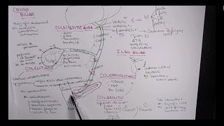 MEJOR EXPLICACIÓN COLELITIASIS COLECISTITIS COLEDOCOLITIASIS COLANGITIS [upl. by Omik]