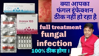 fungal infection full treatment fungal infection symptoms reason and medicine [upl. by Sezen762]