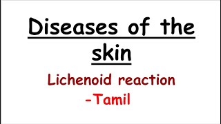 Lichenoid reaction oral pathology tamil [upl. by Shanta160]