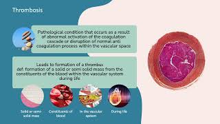 Thrombosis and Virchows Triad [upl. by Adolphus]