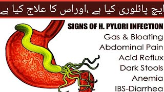 Helicobacter Pylori Infection Causes Signs and Symptoms Diagnosis and Treatment [upl. by Niassuh783]