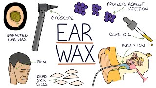 Understanding Ear Wax [upl. by Charry]