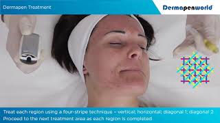 Training Video Dermapen4 standaard [upl. by Alac]