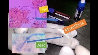 Microfilaria live and dead under Microscope [upl. by Aveline]