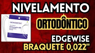 Como fazer o nivelamento dos dentes com o sistema Edgewise braquetes 0022 Aula 190 [upl. by Noet]