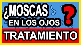 Moscas Volantes en los ojos Tratamiento  3 simples pasos [upl. by Willner406]