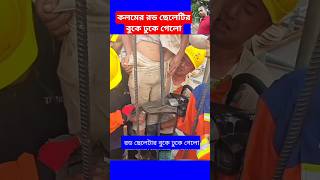 কলমের রড ছেলেটির বুকে ঢুকে গেলোconcrete construction working plan work shorts viral trending [upl. by Bille]