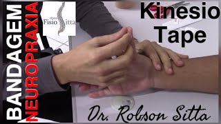 NEUROPRAXIA RADIAL BANDAGEM ELÁSTICA KINESIO TAPE Clínica de Fisioterapia Dr Robson Sitta [upl. by Anhej]