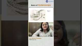 Basics of Hysteroscopy by Dr Raina Chawla  Conceptual OBG [upl. by Aicener597]