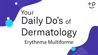 Erythema Multiforme  Daily Dos of Dermatology [upl. by Yelnet123]