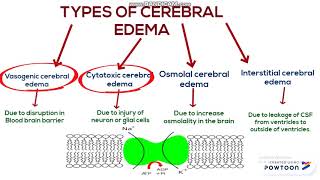 Cerebral edema [upl. by Siulesoj]