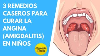 3 REMEDIOS CASEROS PARA CURAR LA ANGINA AMIGDALITIS EN BEBÉS Y NIÑOS  SÍNTOMAS DE AMIGDALITIS [upl. by Keven]