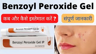 benzoyl peroxide gel 25 how to use hindi  Benzoyl peroxide gel ip benzac ac 25 for acne [upl. by Acinna]