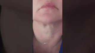 Fascia Blaster Neck Before And After Review  I Transformed My Neck with the FasciaBlaster [upl. by Alehs806]