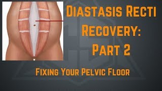 Diastasis Recti Recovery Part 2 Fixing Your Pelvic Floor [upl. by Ahtennek427]