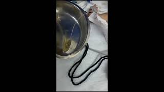 how to insert urine catheter in new born baby [upl. by Bradwell217]