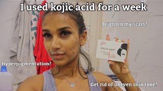 I Used Kojic Acid For A Week amp This Happened  Kojie San Review [upl. by Malorie]