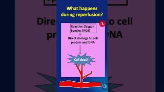 Shorts  119 IschemiaReperfusion Injury IRI  What happens during the reperfusion phase [upl. by Onibag]