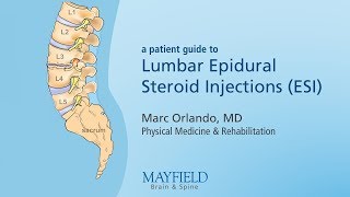 Lumbar Epidural Steroid Injections [upl. by Tildi]