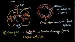 Haemophilus influenzae infection [upl. by Zoila202]