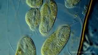 Various Ciliated Protozoa Kingdom Protista DIC Lighting Technique [upl. by Jary]