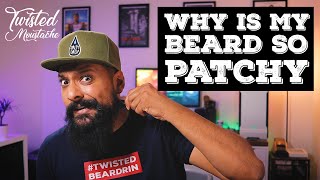 My Beard Is Patchy How To Deal With Patchy Beard Growth [upl. by Serle]