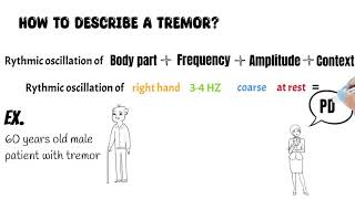 Tremor syndromes All you need to know about tremor types examination and treatment [upl. by Georgina100]