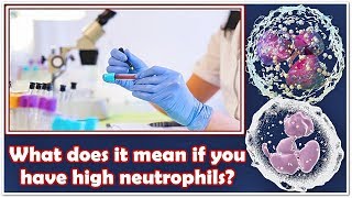 Neutrophils Absolute Count – High Low Causes Normal Range [upl. by Kindig179]