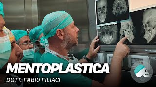 Chirurgia ortognatica  La Genioplastica o mentoplastica  Chirurgia maxillo facciale [upl. by Deloria]