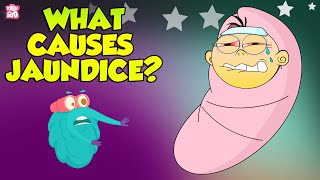 Jaundice  Causes of Jaundice  The Dr Binocs Show  Peekaboo Kidz [upl. by Vinna]