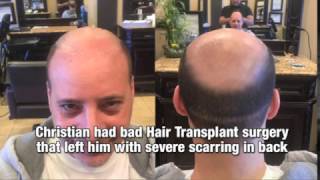 Bald Guy Gets A Hair Tattoo [upl. by Liz]