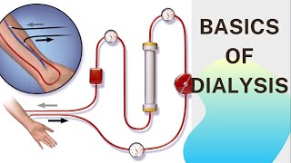 Basic concept of Dialysis Machine  Fresenius 4008S  Dialyzer amp Dialysate Function [upl. by Nataniel]