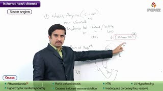 Pathology of Angina Pectoris  Stable Angina  USMLE Step 1 coronary artery disease [upl. by Elleval]